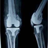 Case 7 – JOCR Oct – Dec 2011 Case 7 – JOCR Oct – Dec 2011