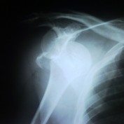 Case 8 – Jan -Mar 2012. Journal of Orthopaedic Case Reports