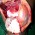 A Case Report of Synovial Chondromatosis of the Knee Joint arising from the Marginal Synovium
