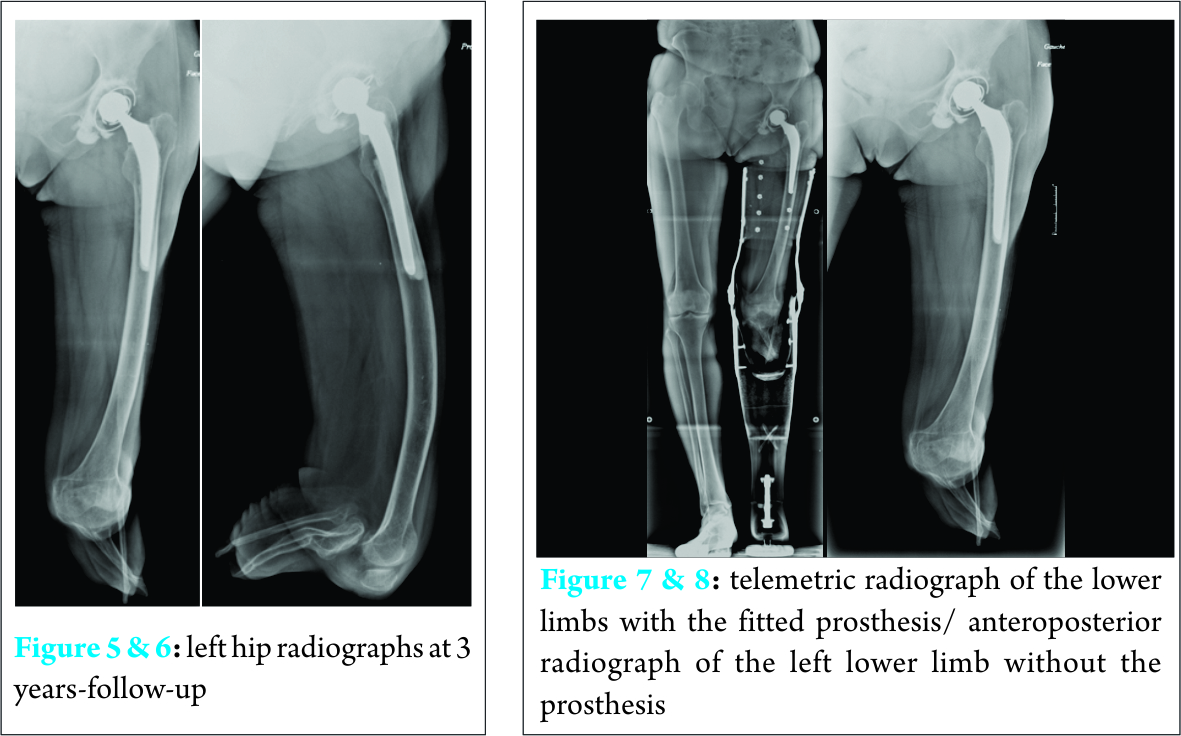 FIg 5 6 7 8