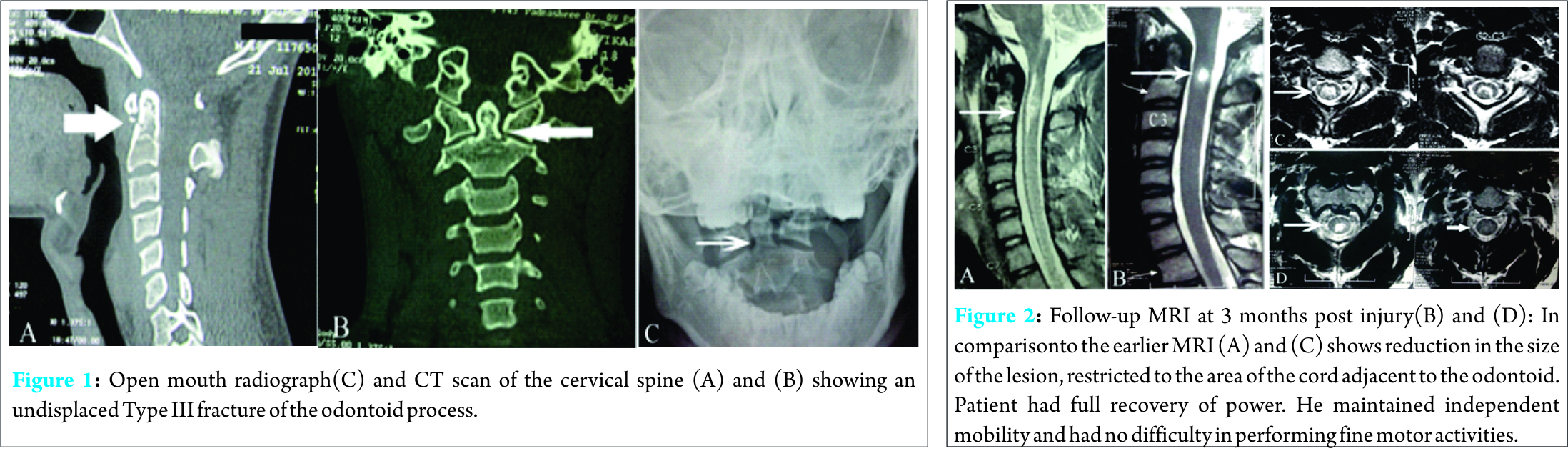 Fig 1 2