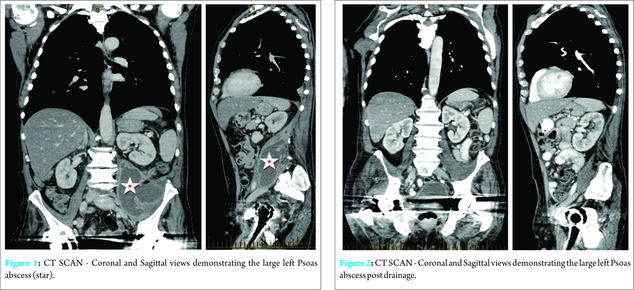 Fig 1 2