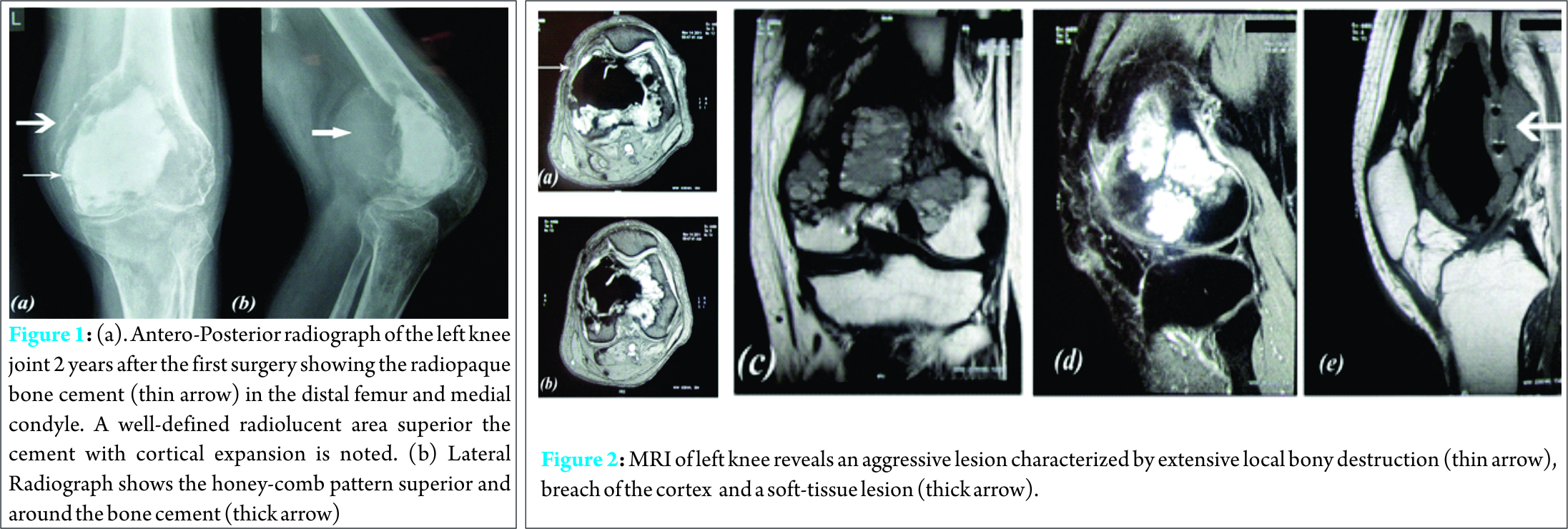 Fig 1 2