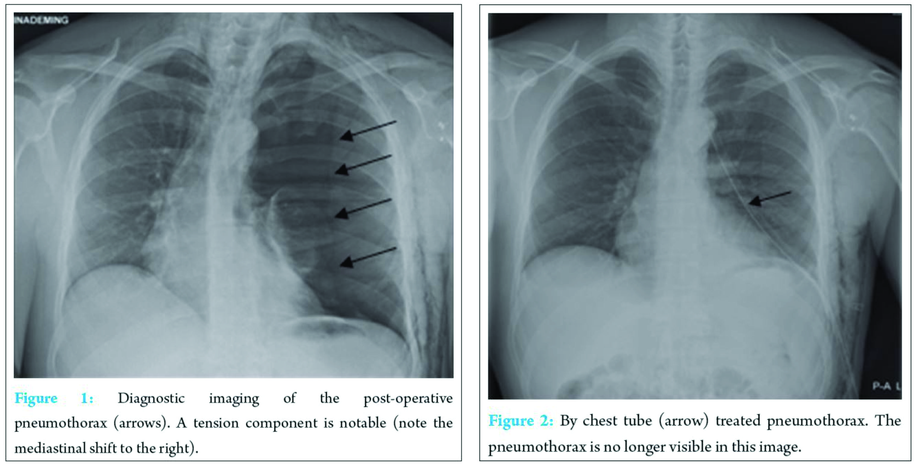 fig-1-2