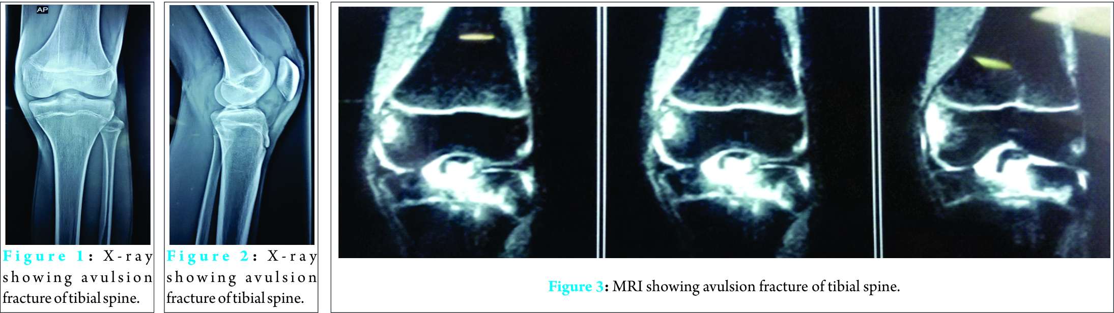 Fig 1 2 3