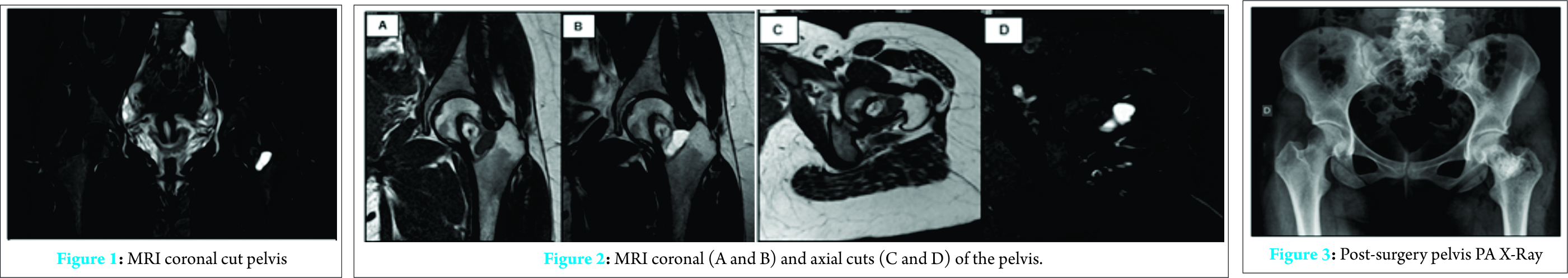 Fig 1 2 3