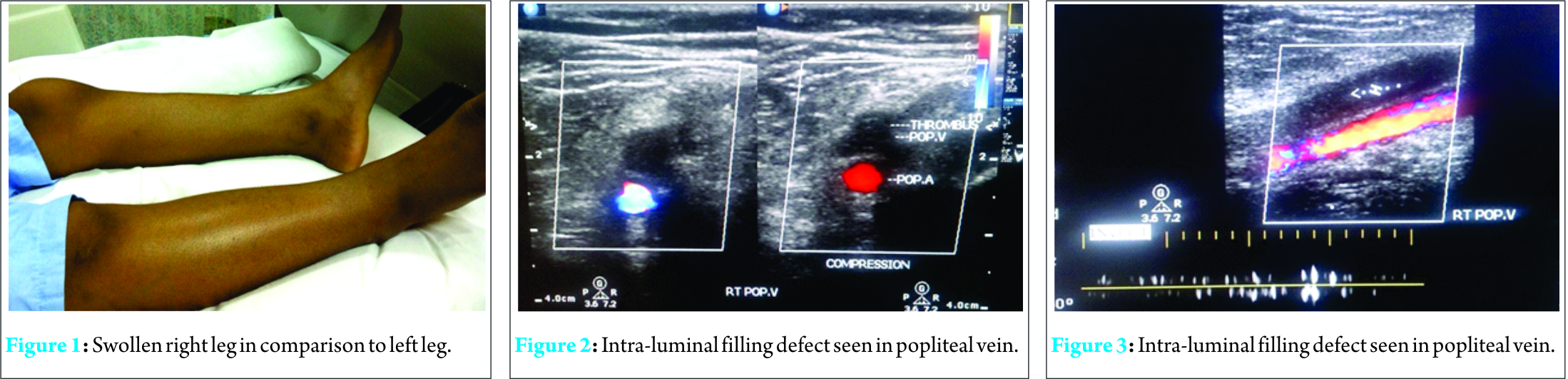 Fig 1 2 3