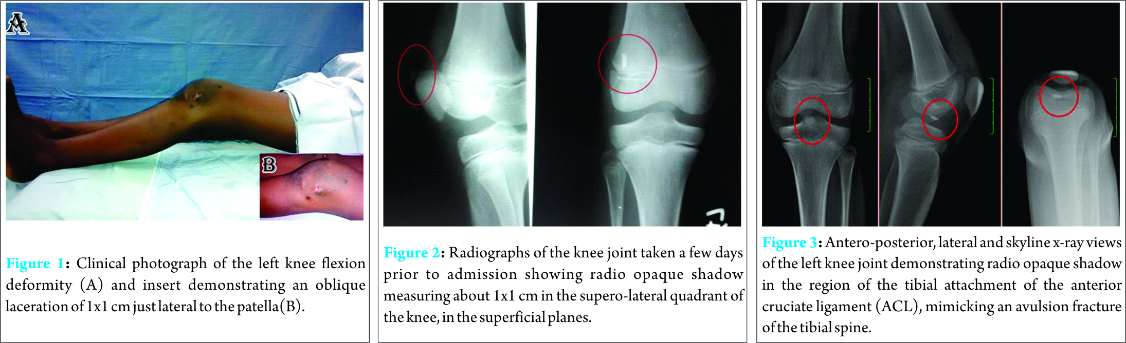 Fig 1 2 3