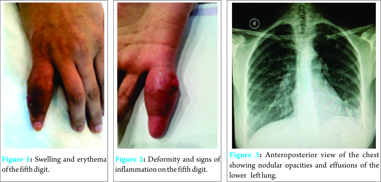 Fig 1 2 3