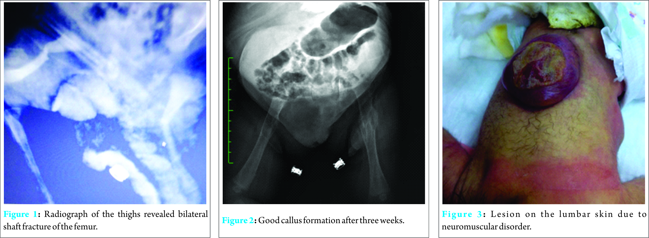 Fig 1 2 3