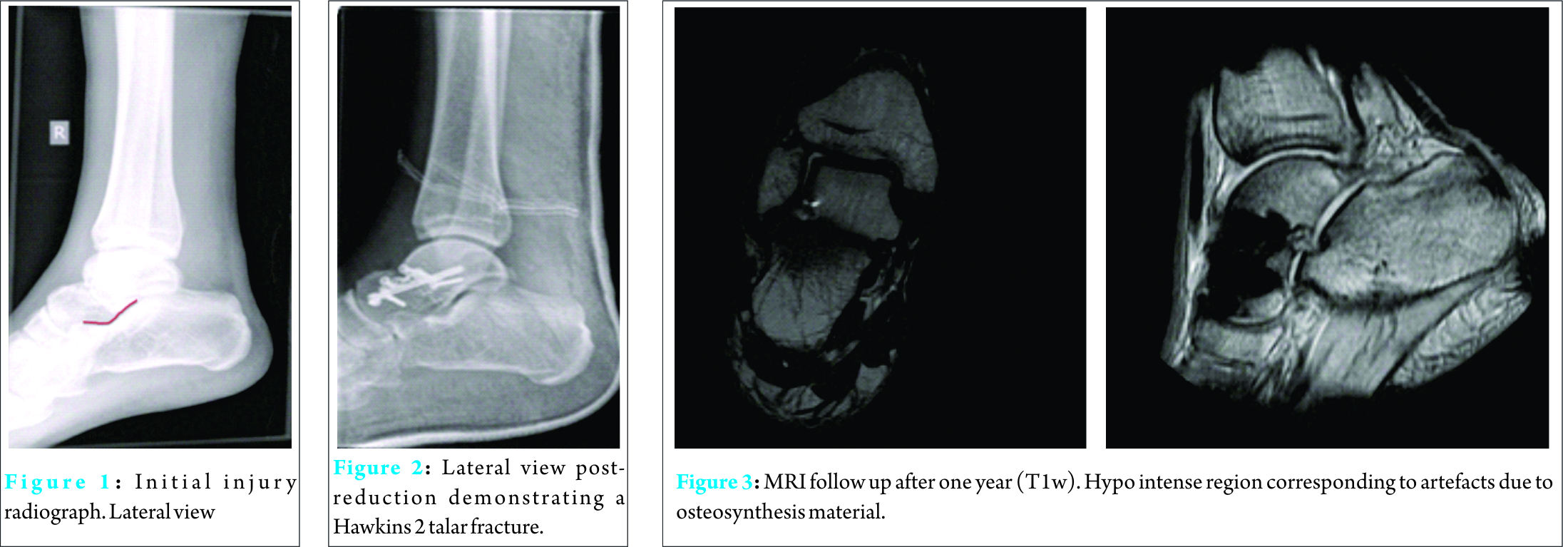 Fig 1 2 3