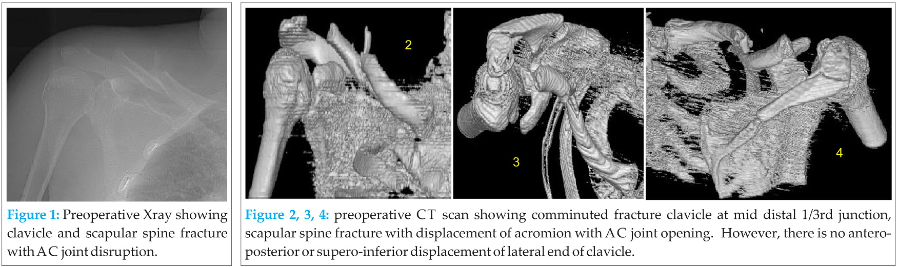 Fig 1 2 3 4