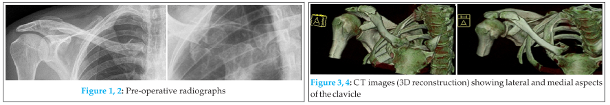 Fig 1, 2, 3, 4