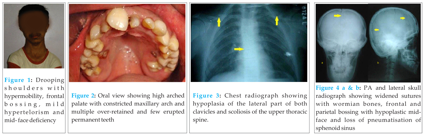 Fig 1 2 3 4