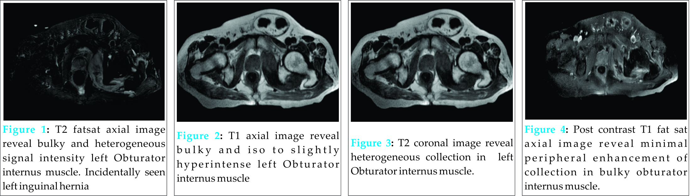 Fig 1 2 3 4