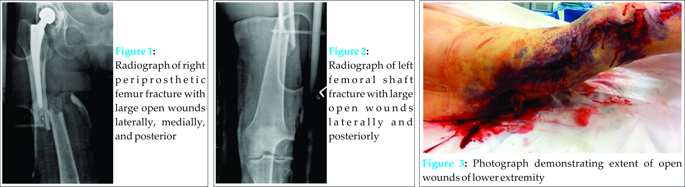 Fig 1 2 3