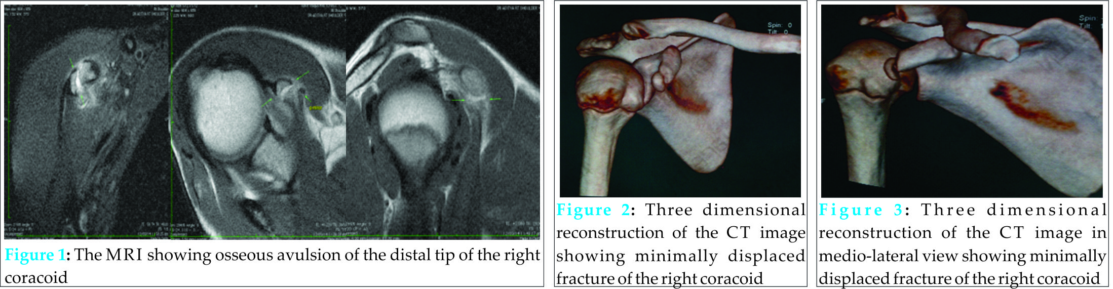 Fig 1 2 3