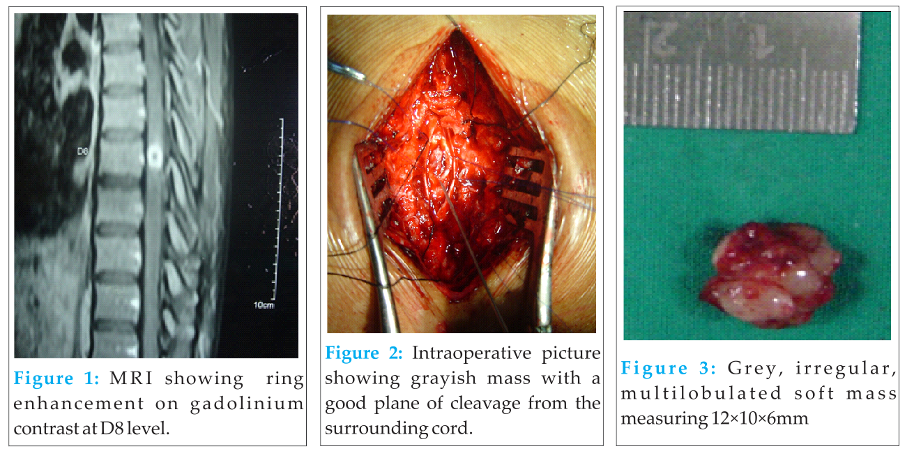 Fig 1 2 3