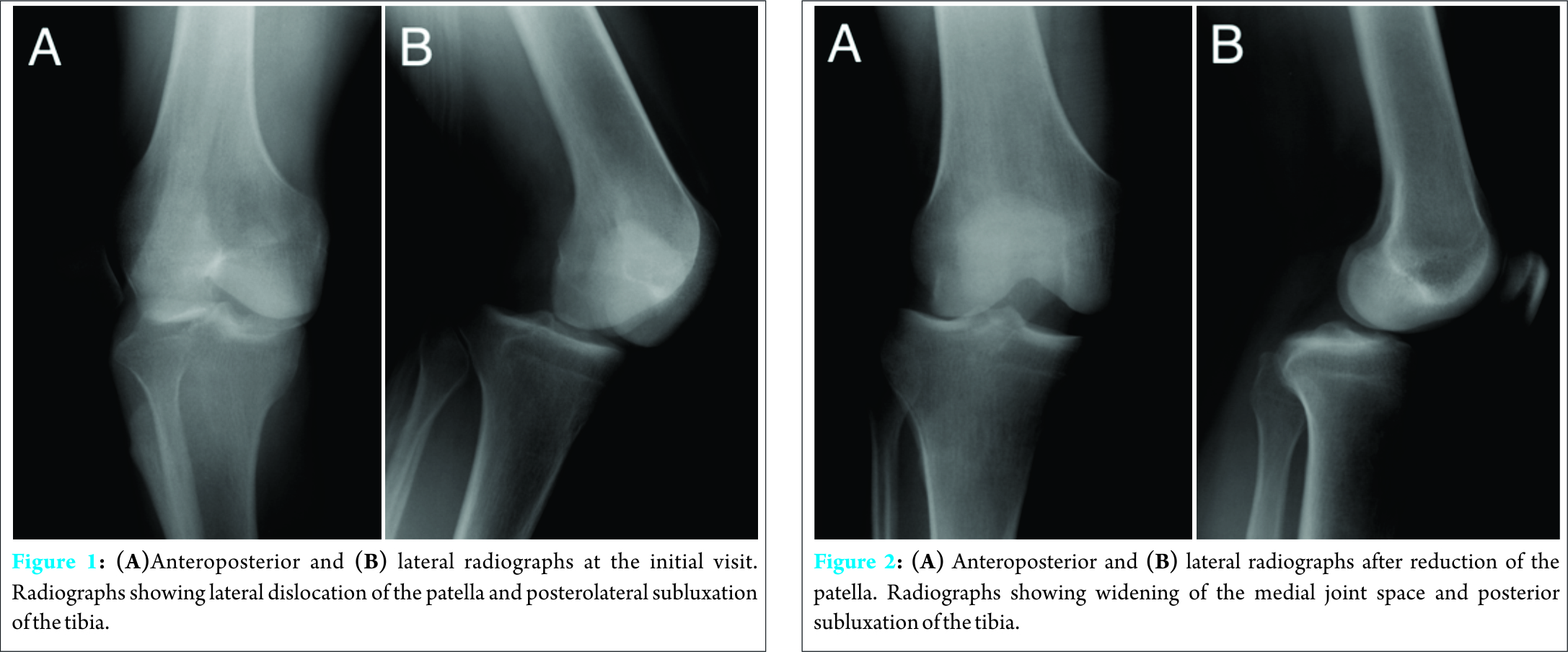 Fig 1 2