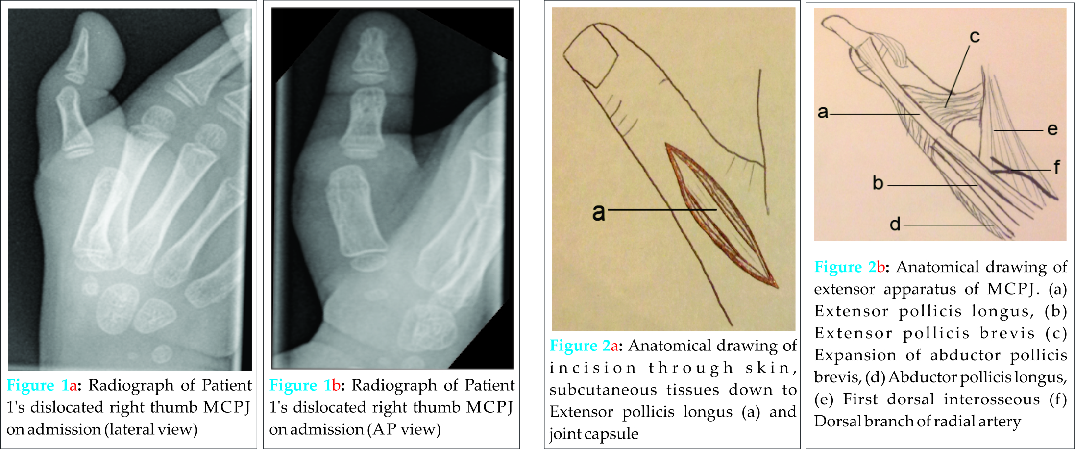 Fig 1 2