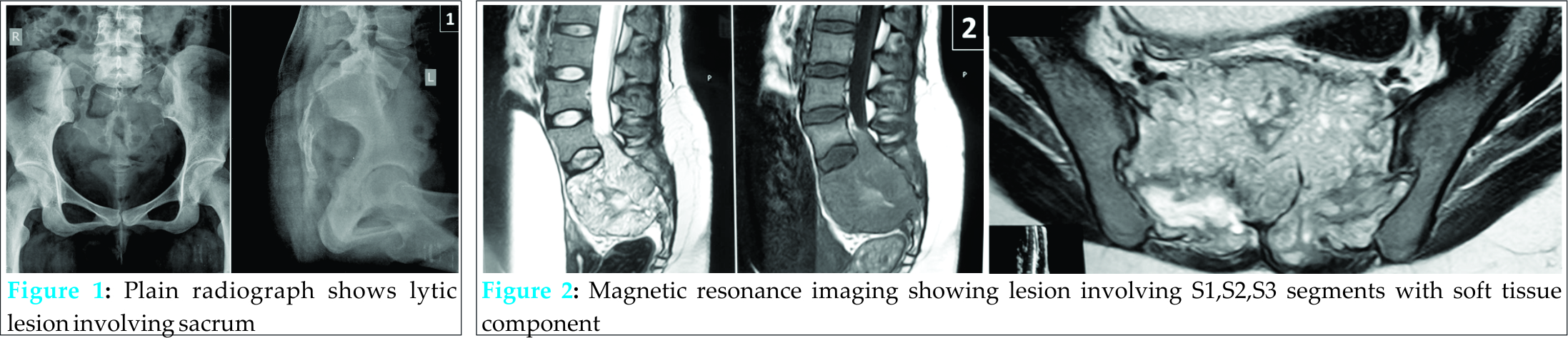 Fig 1 2