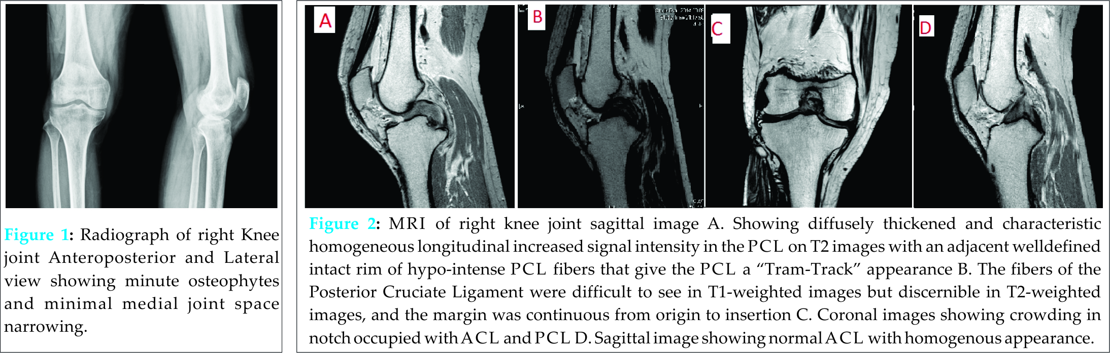 Fig 1 2