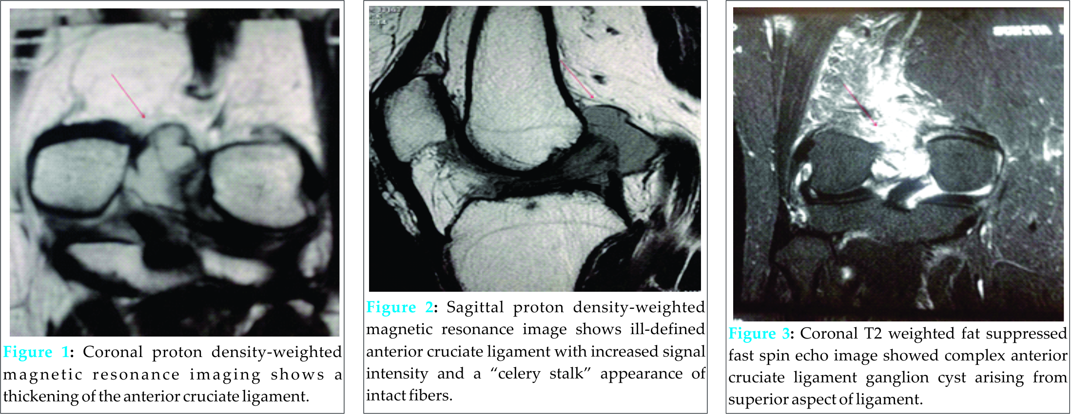 Fig 1-3