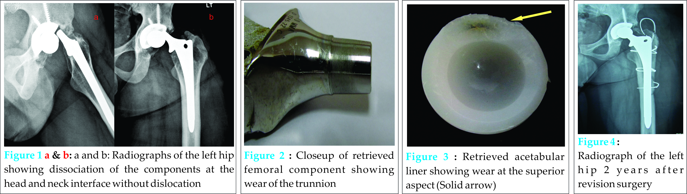 Fig 1-4