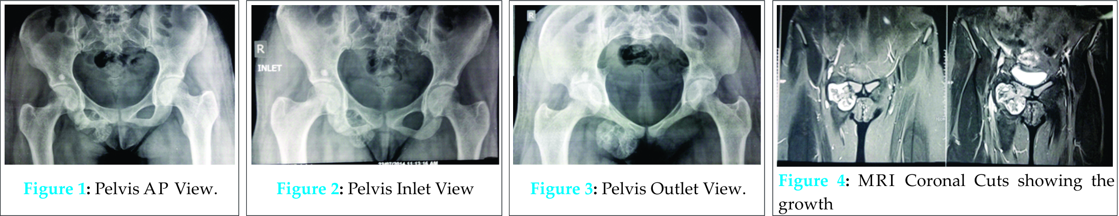 Fig 1-4