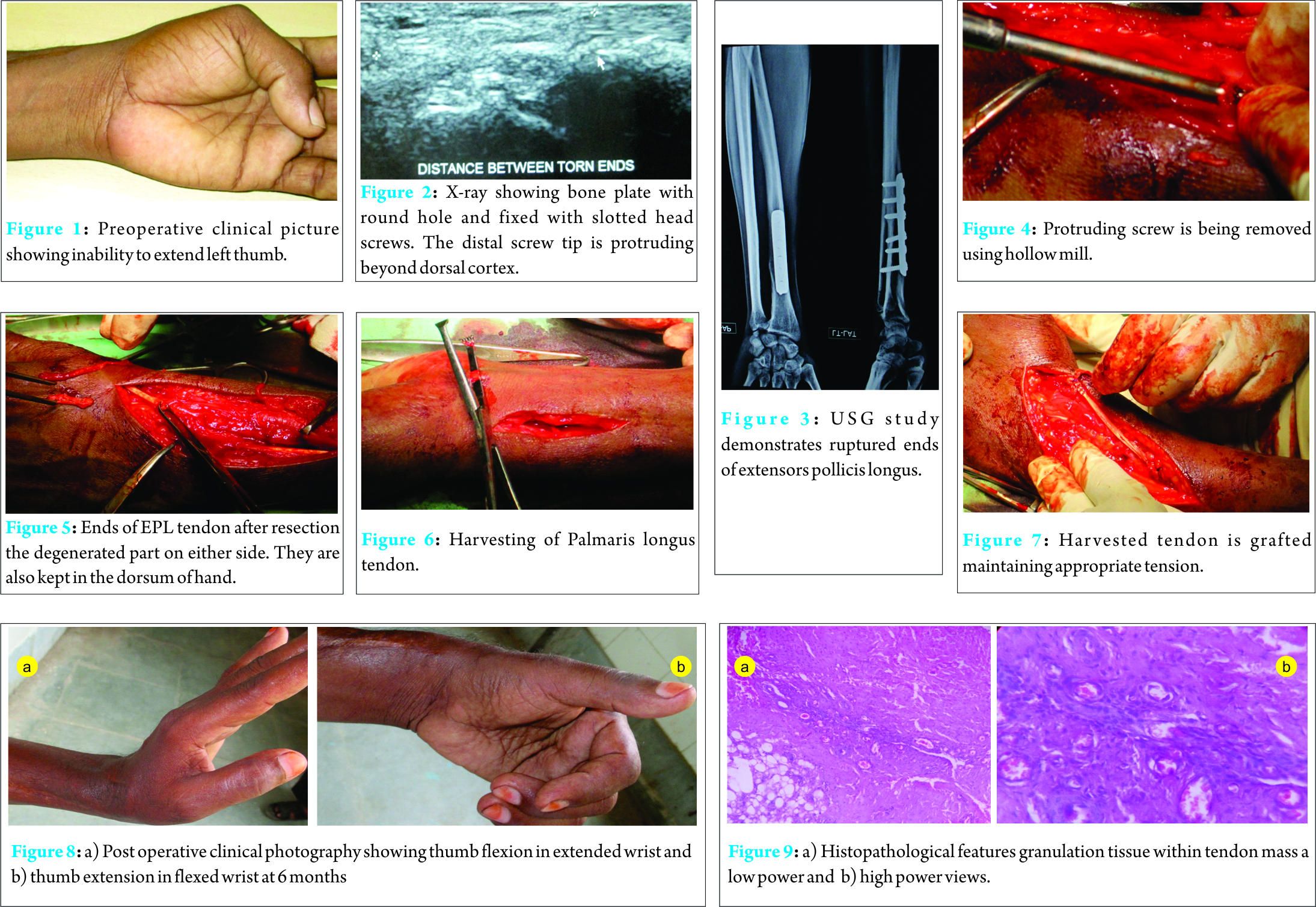 Fig 1 to 9