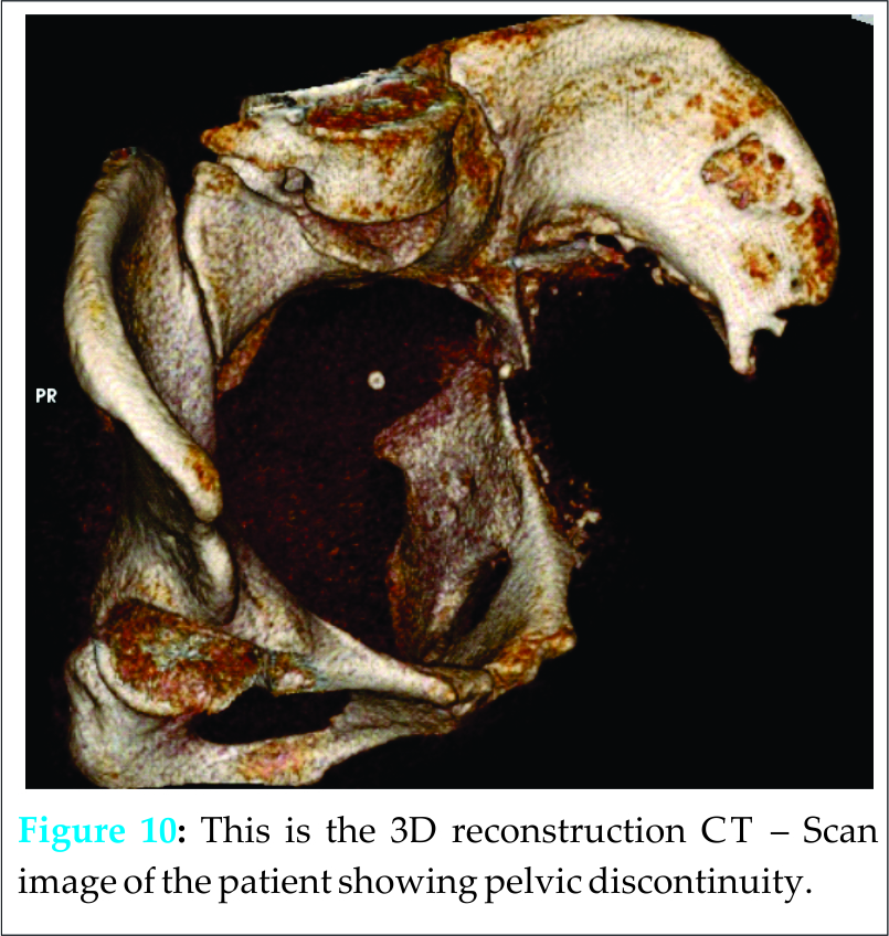 Fig 10