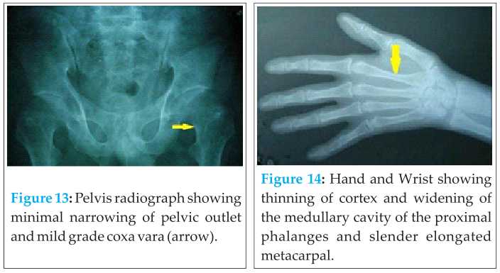 Fig 13 14