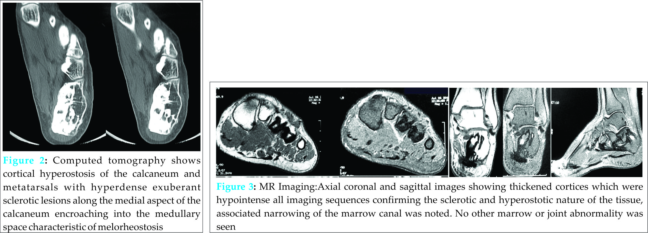 Fig 2 3