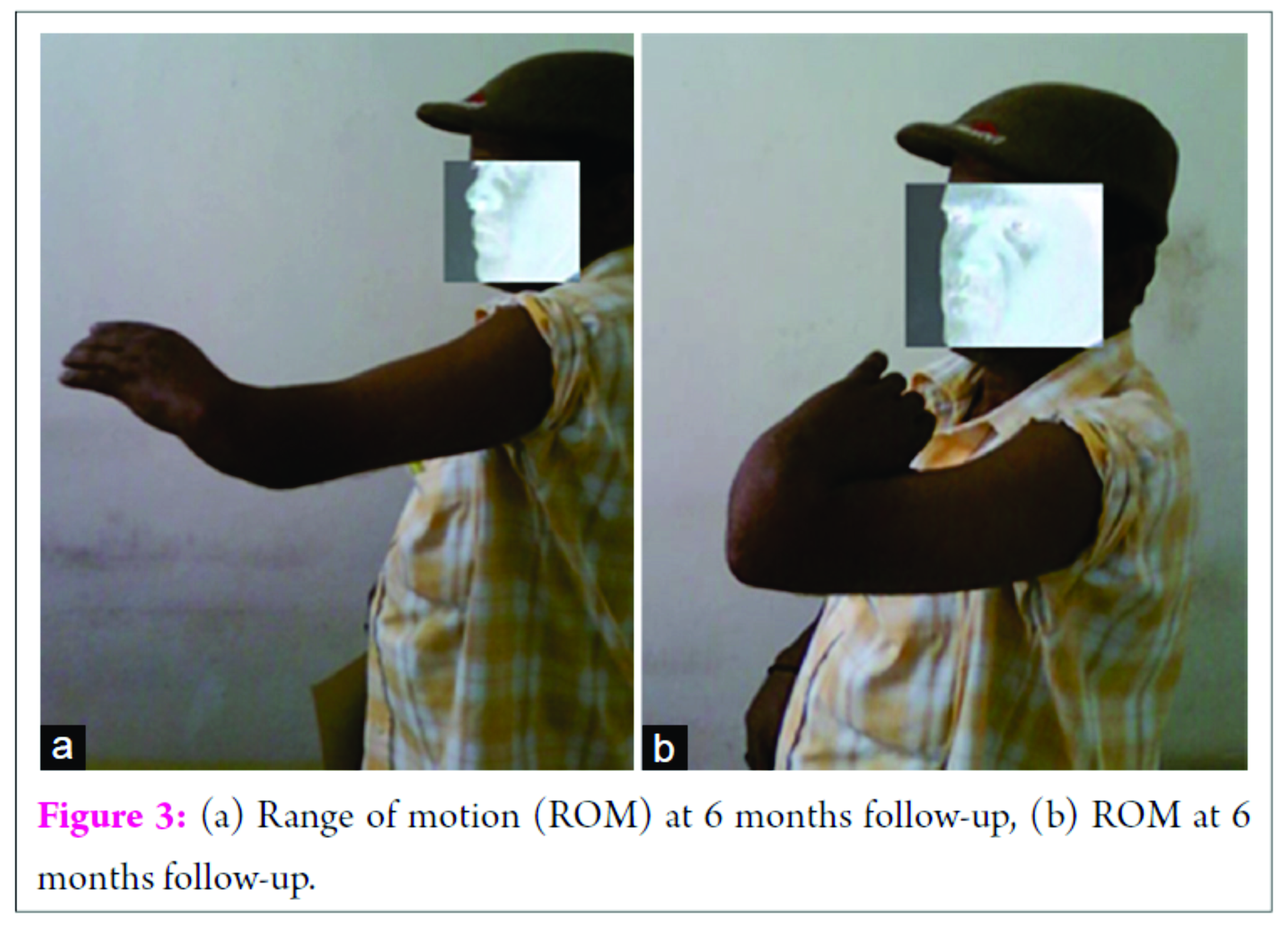 fig-3