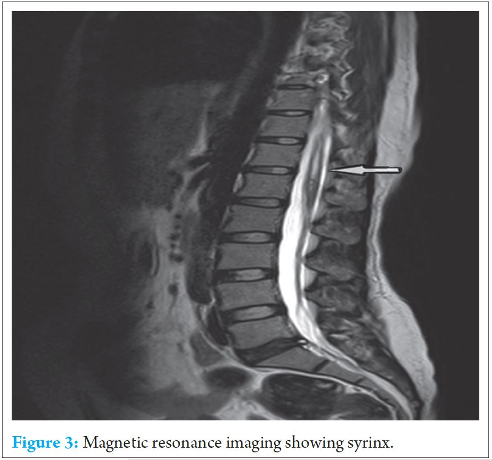 fig-3