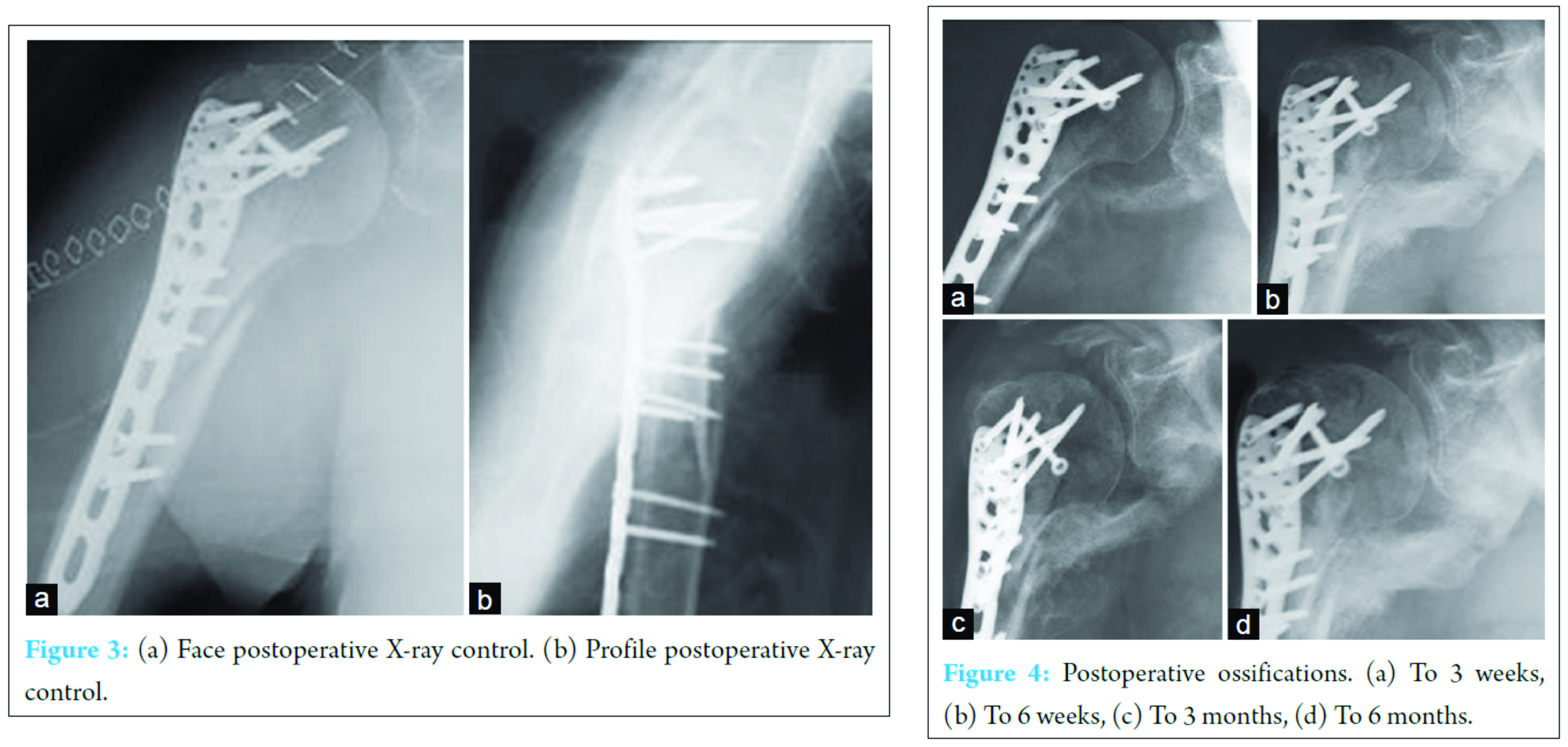 fig-3-4