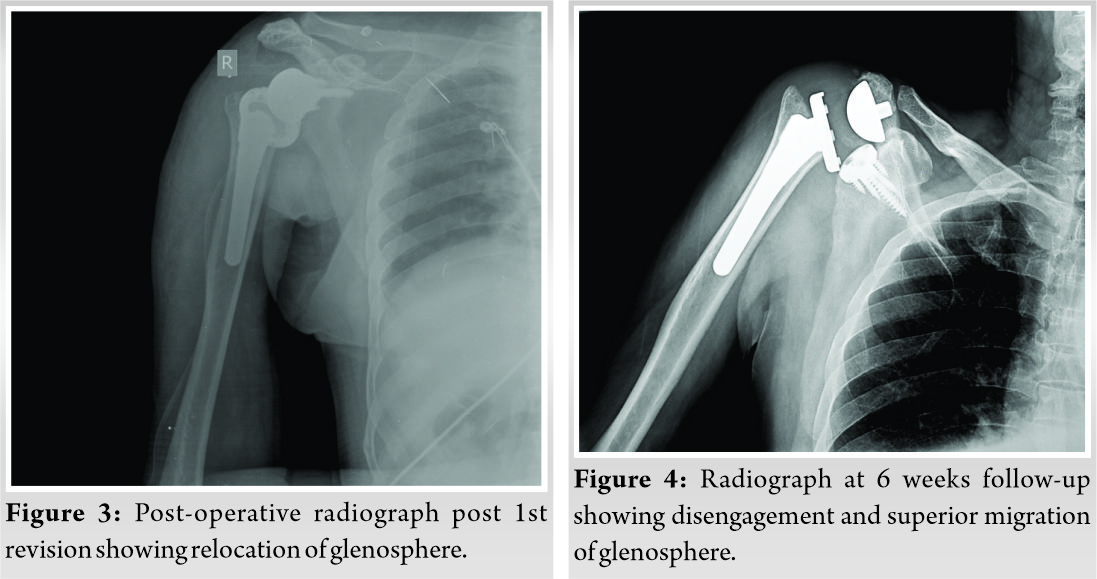 Fig-3-4-196