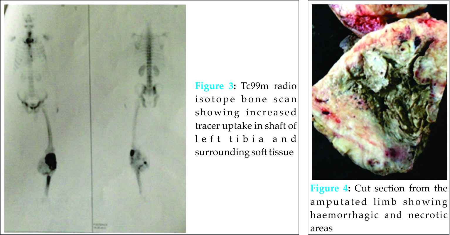 Fig 3 4