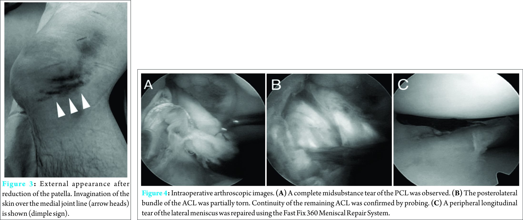 Fig 3 4