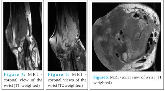 Fig 3, 4 & 5