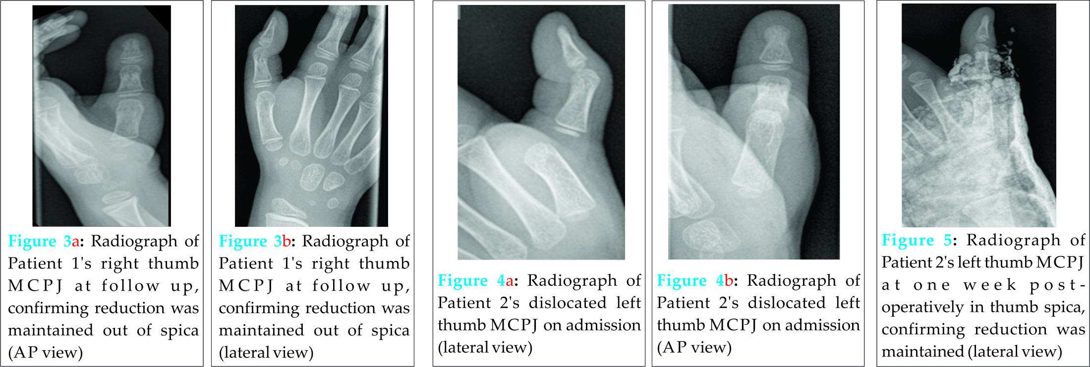 Fig 3 4 5