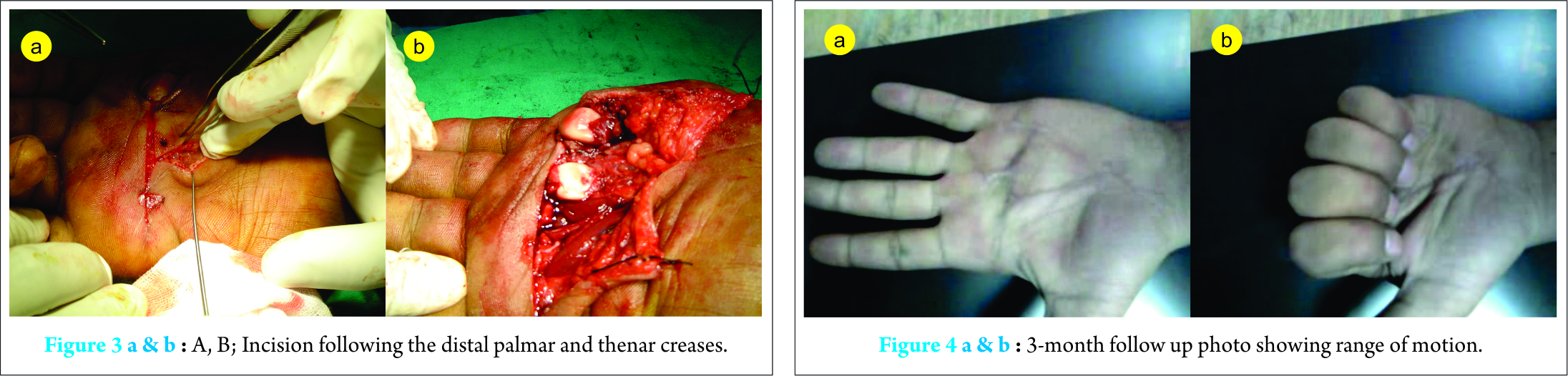 Fig 3 4