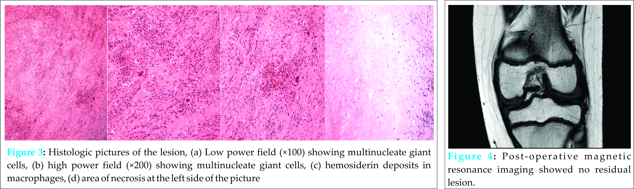 Fig 3 4