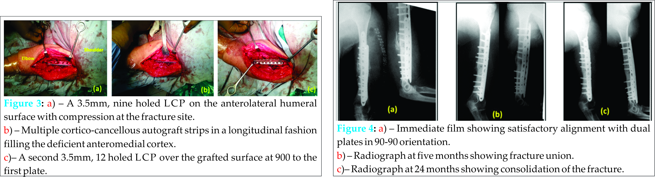 Fig 3 4