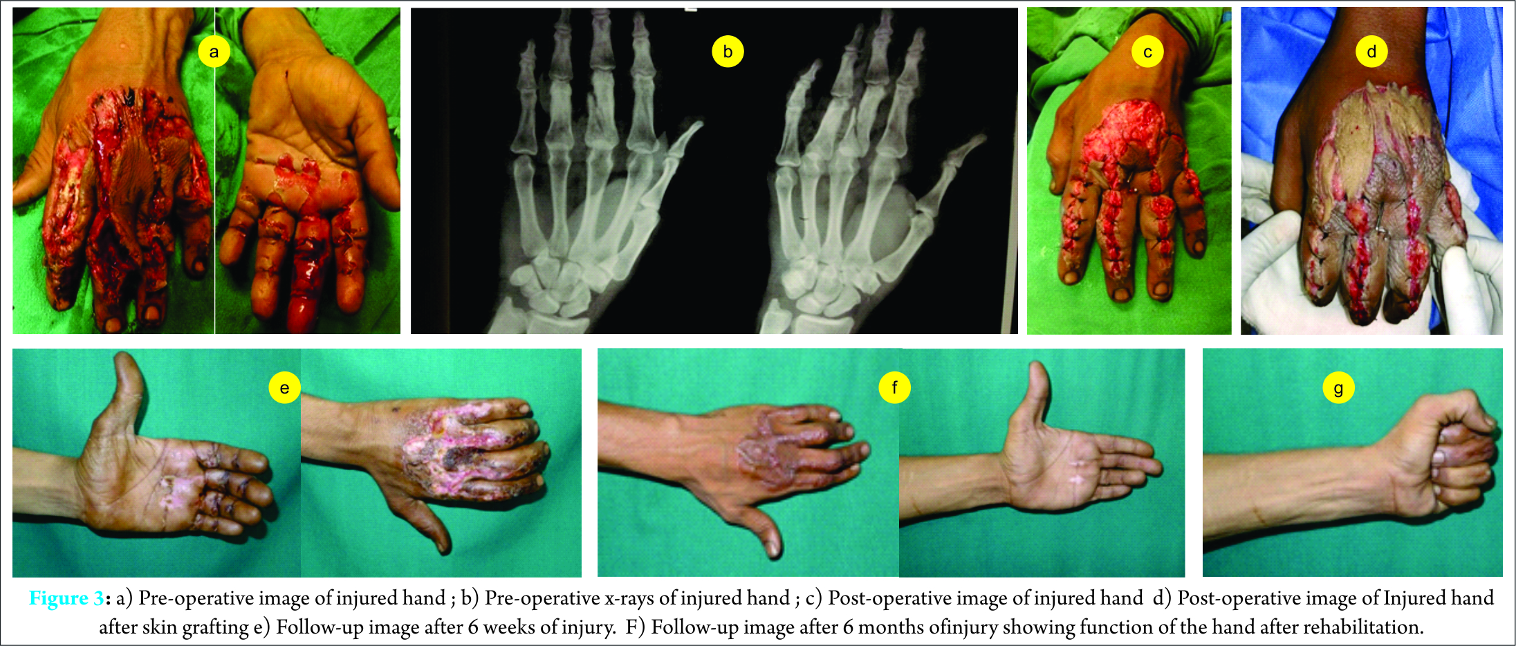 Fig 3