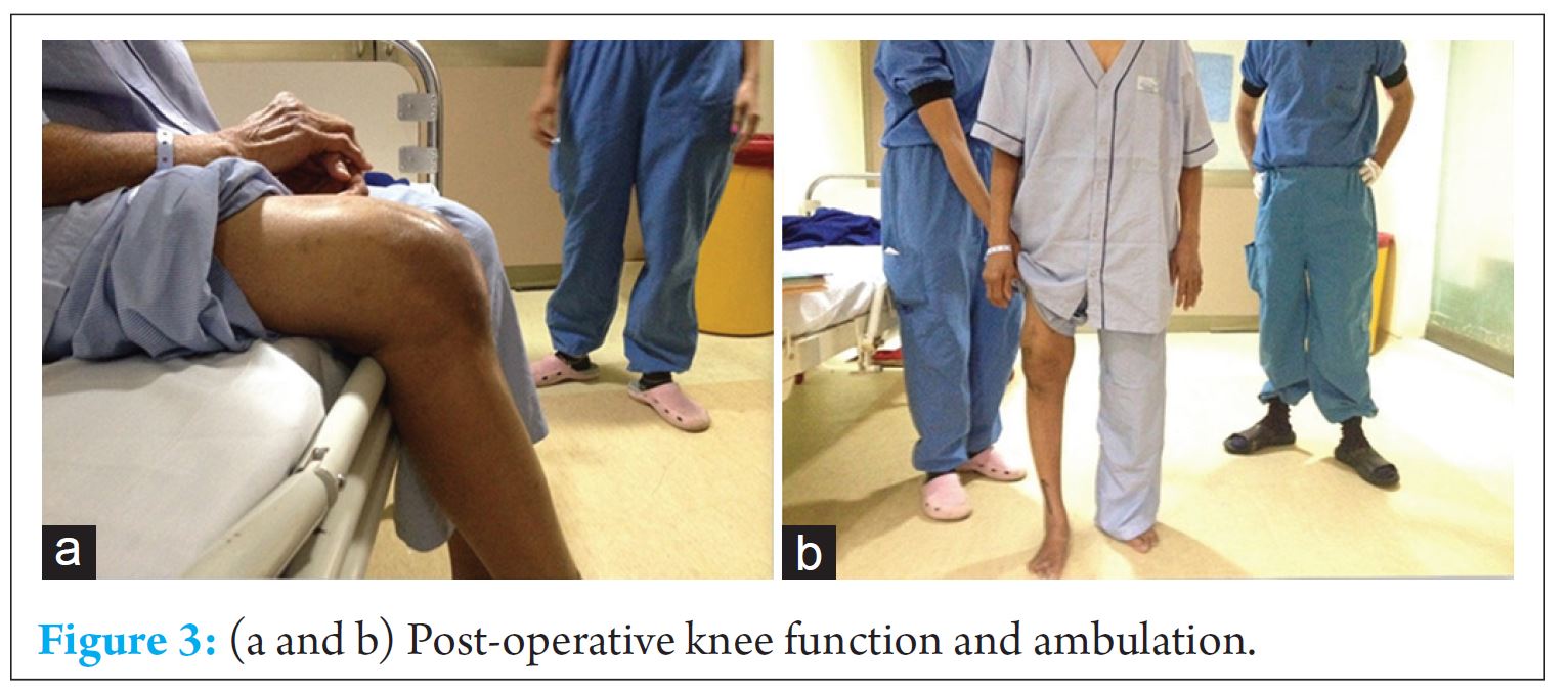 fig-3