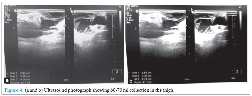 fig-4