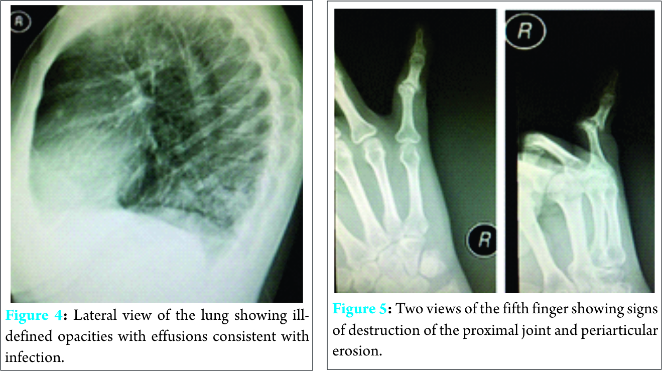 Fig 4 5 6