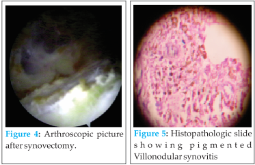 Fig 4 5