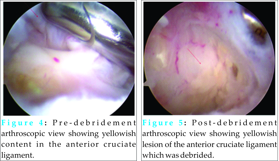 Fig 4-5